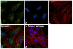 Invitrogen Emerin Monoclonal Antibody (MANEM1(5D10)) 100 &mu;L; Unconjugated:Antibodies,