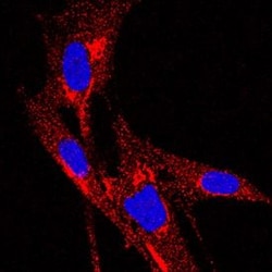 Invitrogen TIMP1 Monoclonal Antibody (63515) 500 &mu;g | Buy Online | Invitrogen&trade; | Fisher Scientific