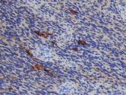 Invitrogen TIMP1 Monoclonal Antibody (63515) 500 &mu;g | Buy Online | Invitrogen&trade; | Fisher Scientific