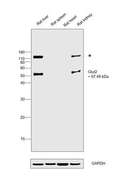 Invitrogen GLUT2 Monoclonal Antibody (205115) 200 &mu;g; Unconjugated:Antibodies,