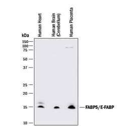 Invitrogen FABP5 Monoclonal Antibody (311215) 100 &mu;g; Unconjugated:Antibodies,