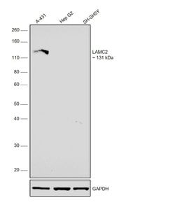 Invitrogen Laminin gamma-2 Monoclonal Antibody (CL2980) 100 &mu;L; Unconjugated:Antibodies,
