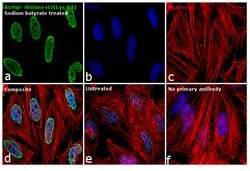 Invitrogen H3K14ac Recombinant Rabbit Monoclonal Antibody (RM130) 100 &mu;g | Buy Online | Invitrogen&trade; | Fisher Scientific