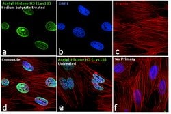 Invitrogen H3K18ac Recombinant Rabbit Monoclonal Antibody (RM166) 100 &mu;g;