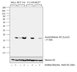 Invitrogen H3K23ac Recombinant Rabbit Monoclonal Antibody (RM169) 100 &mu;g;