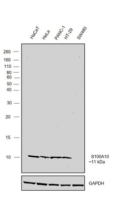 Invitrogen S100A10 Monoclonal Antibody (6F4-E6-D5-C10) 100 &mu;L | Buy Online | Invitrogen&trade; | Fisher Scientific