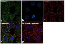 Invitrogen PRKAR1A Monoclonal Antibody (OTI6C7) 100 &mu;L | Buy Online | Invitrogen&trade; | Fisher Scientific