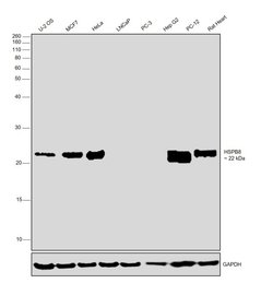 Invitrogen HSPB8 Monoclonal Antibody (OTI1E3) 100 &mu;L | Buy Online | Invitrogen&trade; | Fisher Scientific