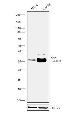 Invitrogen KHK Monoclonal Antibody (OTI1D8) 100 &mu;L; Unconjugated:Antibodies,