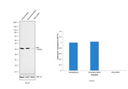 Invitrogen KHK Monoclonal Antibody (OTI1D8) 100 &mu;L; Unconjugated:Antibodies,