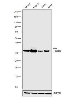 Invitrogen KHK Monoclonal Antibody (OTI4E9) 100 &mu;L; Unconjugated:Antibodies,