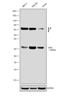 Invitrogen KHK Monoclonal Antibody (OTI3D1) 100 &mu;L; Unconjugated:Antibodies,