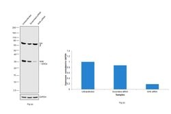 Invitrogen KHK Monoclonal Antibody (OTI3D1) 100 &mu;L; Unconjugated:Antibodies,