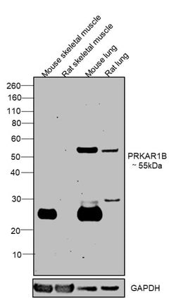 Invitrogen PRKAR1B Monoclonal Antibody (OTI9C5) 100 &mu;L; Unconjugated:Antibodies,