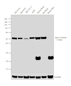 Invitrogen beta-4 Tubulin Monoclonal Antibody (OTI3C12) 100 &mu;L; Unconjugated:Antibodies,