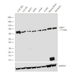 LIMK1 Monoclonal Antibody (OTI6B4):Antibodies, Monoclonal