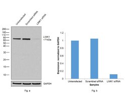 LIMK1 Monoclonal Antibody (OTI6B4):Antibodies, Monoclonal
