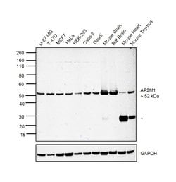 Invitrogen AP2M1 Monoclonal Antibody (OTI1B11) 100 &mu;L; Unconjugated:Antibodies,