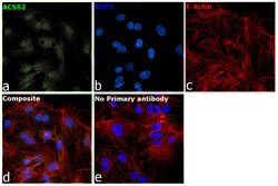 Invitrogen ACSS2 Monoclonal Antibody (OTI3H4) 100 &mu;L; Unconjugated:Antibodies,