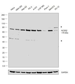 Invitrogen ACSS2 Monoclonal Antibody (OTI3H4) 100 &mu;L; Unconjugated:Antibodies,
