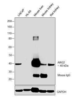 Invitrogen Arginase 2 Monoclonal Antibody (OTI3G5) 100 &mu;L; Unconjugated:Antibodies,