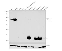 Invitrogen SR-BI Monoclonal Antibody (OTI1F3) 100 &mu;L; Unconjugated:Antibodies,