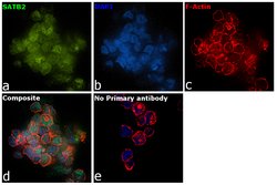 Invitrogen SATB2 Monoclonal Antibody (OTI7E11) 100 &mu;L; Unconjugated:Antibodies,
