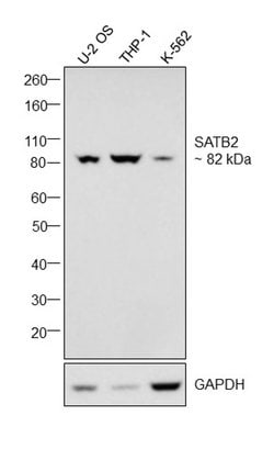 Invitrogen SATB2 Monoclonal Antibody (OTI7E11) 100 &mu;L; Unconjugated:Antibodies,