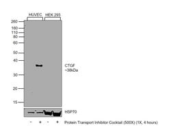 Invitrogen CTGF Monoclonal Antibody (OTI6D1) 100 &mu;L; Unconjugated:Antibodies,