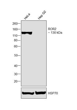 Invitrogen ROR2 Monoclonal Antibody (OTI3H3) 100 &mu;L; Unconjugated:Antibodies,