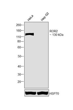 Invitrogen ROR2 Monoclonal Antibody (OTI4B10) 100 &mu;L; Unconjugated:Antibodies,