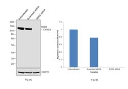 Invitrogen ROR2 Monoclonal Antibody (OTI4B10) 100 &mu;L; Unconjugated:Antibodies,
