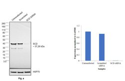 Invitrogen SCD Monoclonal Antibody (CD.E10) 100 &mu;g; Unconjugated:Antibodies,
