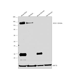 Invitrogen KCC2 Monoclonal Antibody (N1/12) 100 &mu;g; Unconjugated:Antibodies,