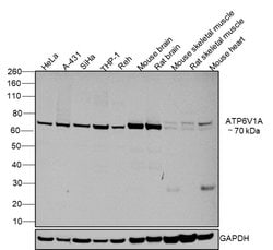 Invitrogen ATP6V1A Monoclonal Antibody (GT3846) 100 &mu;L; Unconjugated:Antibodies,
