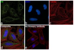 Invitrogen Fumarase Monoclonal Antibody (GT7612) 100 &mu;L; Unconjugated:Antibodies,