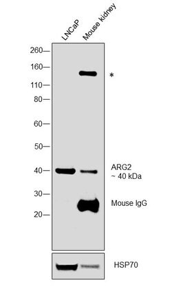 Invitrogen Arginase 2 Monoclonal Antibody (GT11111) 100 &mu;L; Unconjugated:Antibodies,