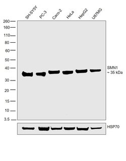 Invitrogen SMN1/SMN2 Monoclonal Antibody (2B10) 100 &mu;g; Unconjugated:Antibodies,