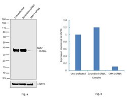 Invitrogen SMN1/SMN2 Monoclonal Antibody (2B10) 100 &mu;g; Unconjugated:Antibodies,