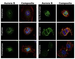Invitrogen Aurora B Recombinant Rabbit Monoclonal Antibody (RM278) 100