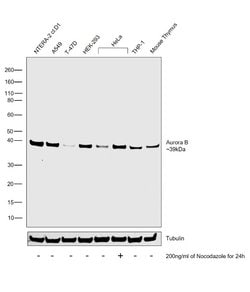Invitrogen Aurora B Recombinant Rabbit Monoclonal Antibody (RM278) 100