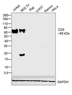 Invitrogen CD5 Recombinant Rabbit Monoclonal Antibody (RM314) 100 &mu;L;