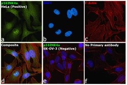 Invitrogen p16INK4a Recombinant Rabbit Monoclonal Antibody (RM267) 100 &mu;L | Buy Online | Invitrogen&trade; | Fisher Scientific