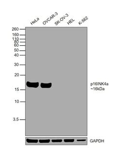 Invitrogen p16INK4a Recombinant Rabbit Monoclonal Antibody (RM267) 100 &mu;L | Buy Online | Invitrogen&trade; | Fisher Scientific