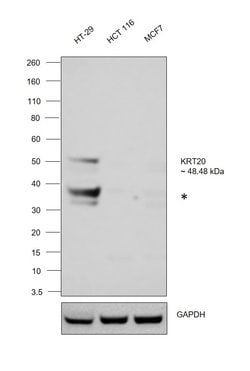 Invitrogen Cytokeratin 20 Recombinant Rabbit Monoclonal Antibody (RM283)