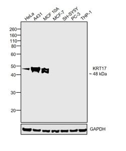 Invitrogen Cytokeratin 17 Recombinant Rabbit Monoclonal Antibody (RM351)