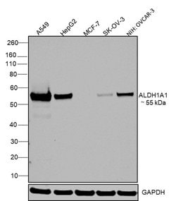 Invitrogen ALDH1A1 Monoclonal Antibody (5G9E6C9) 100 &mu;L; Unconjugated:Antibodies,