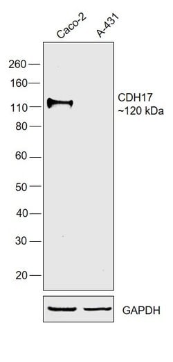 Invitrogen CDH17 Monoclonal Antibody (05) 100 &mu;L; Unconjugated:Antibodies,