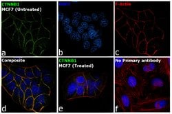 Invitrogen beta Catenin Recombinant Rabbit Monoclonal Antibody (021) 100