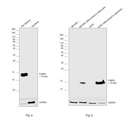 FABP4 Recombinant Rabbit Monoclonal Antibody (001):Antibodies, Recombinant